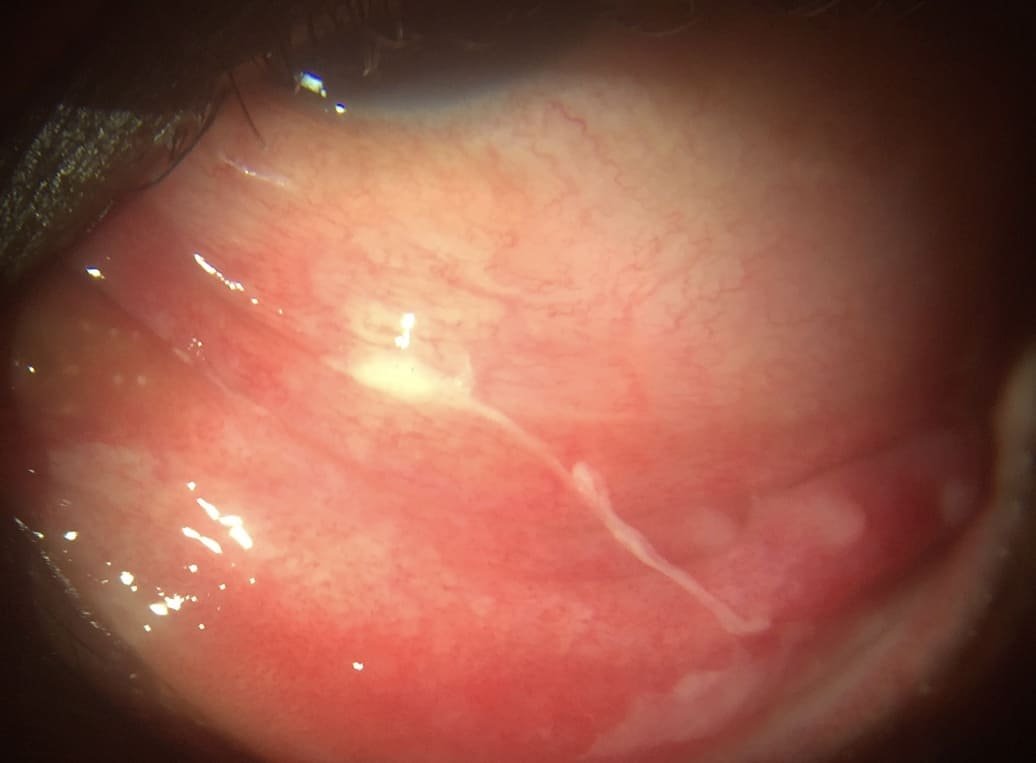 hospital in Virugambakkam